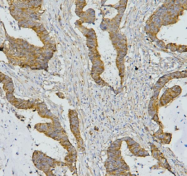 2 - Anti-AIF/AIFM1 Antibody Picoband™ (monoclonal, 2I5) ABO14853