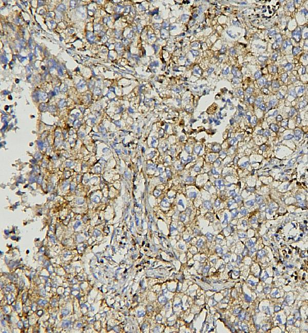 2 - Anti-AIF/AIFM1 Antibody Picoband™ (monoclonal, 2I5) ABO14853