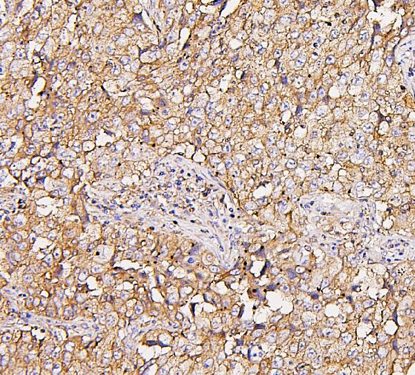 2 - Anti-NMI Antibody Picoband™ (monoclonal, 2F3) ABO14854