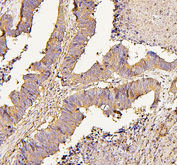 2 - Anti-NMI Antibody Picoband™ (monoclonal, 2F3) ABO14854