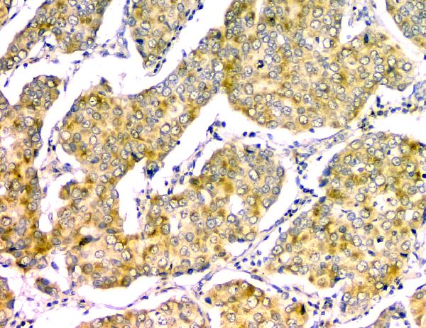 2 - Anti-GM130 GOLGA2 Antibody Picoband™ (monoclonal, 6D4) ABO14855