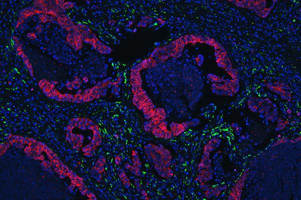 1 - Anti-E Cadherin 1 CDH1 Antibody Picoband™ (monoclonal, 9G2) ABO14856