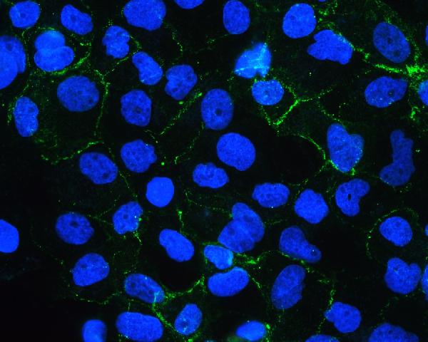 2 - Anti-E Cadherin 1 CDH1 Antibody Picoband™ (monoclonal, 9G2) ABO14856