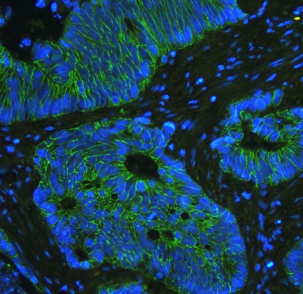 1 - Anti-E Cadherin 1 CDH1 Antibody Picoband™ (monoclonal, 9G2) ABO14856