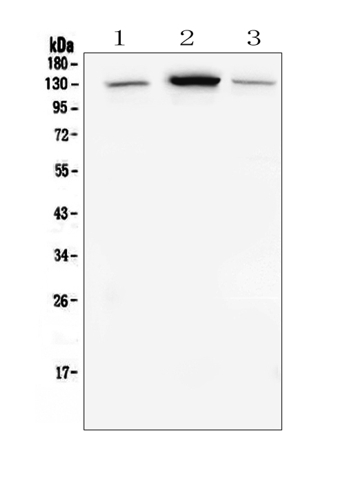 1 - Anti-E Cadherin 1 CDH1 Antibody Picoband™ (monoclonal, 9G2) ABO14856