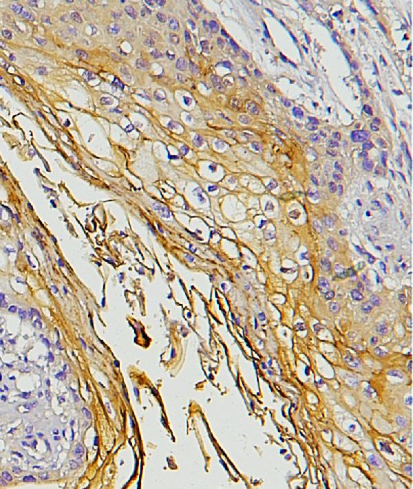 2 - Anti-E Cadherin 1 CDH1 Antibody Picoband™ (monoclonal, 9G2) ABO14856