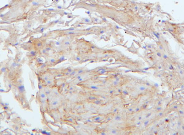 2 - Anti-E Cadherin 1 CDH1 Antibody Picoband™ (monoclonal, 9G2) ABO14856