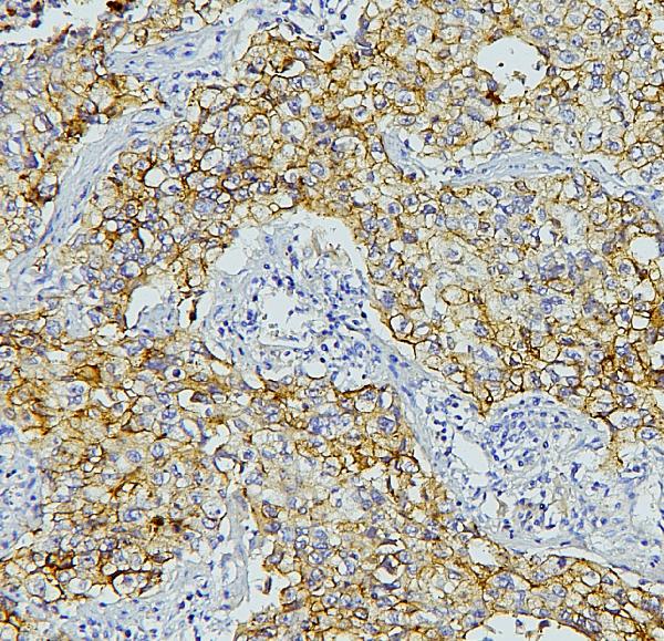 2 - Anti-E Cadherin 1 CDH1 Antibody Picoband™ (monoclonal, 9G2) ABO14856