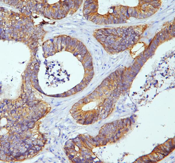 2 - Anti-E Cadherin 1 CDH1 Antibody Picoband™ (monoclonal, 9G2) ABO14856
