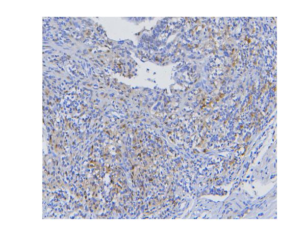 2 - Anti-STAT1 Antibody Picoband™ (monoclonal, 12C7) ABO14857