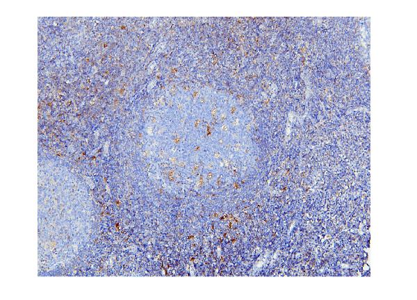 2 - Anti-STAT1 Antibody Picoband™ (monoclonal, 12C7) ABO14857