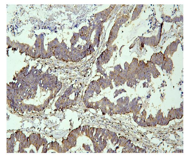 2 - Anti-PPT1 Antibody Picoband™ (monoclonal, 10F3) ABO14860