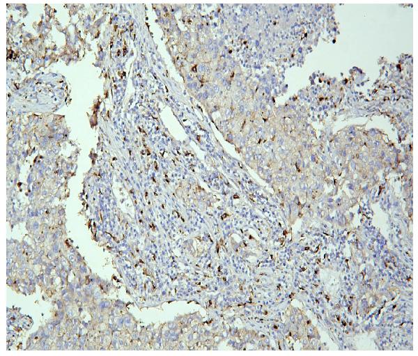 2 - Anti-PPT1 Antibody Picoband™ (monoclonal, 10F3) ABO14860