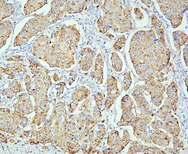 2 - Anti-PPT1 Antibody Picoband™ (monoclonal, 10F3) ABO14860
