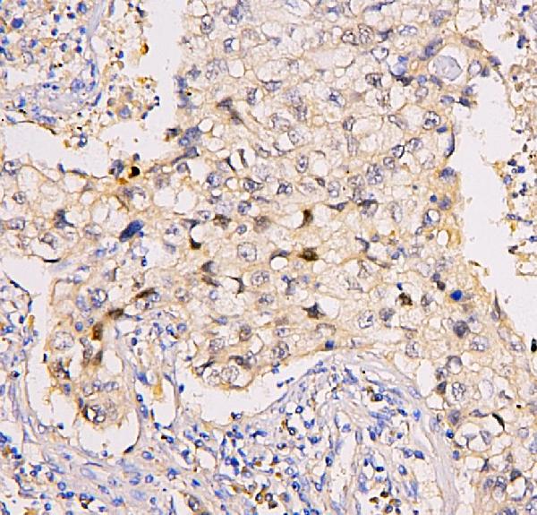 2 - Anti-BRG1 SMARCA4 Antibody Picoband™ (monoclonal, 3F4) ABO14862