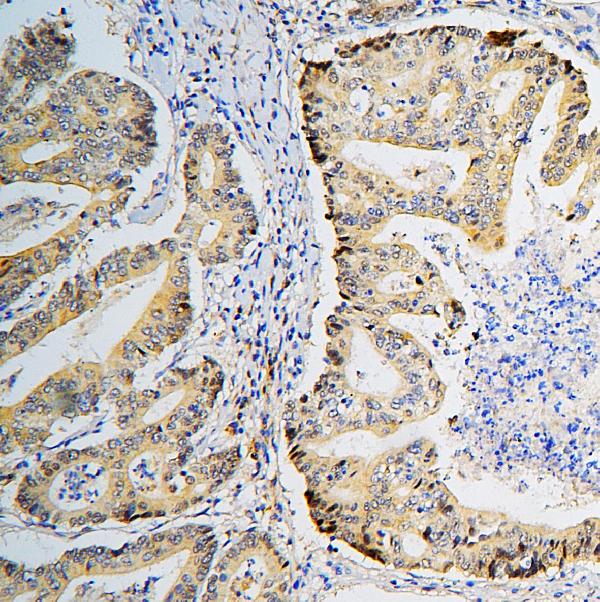 2 - Anti-BRG1 SMARCA4 Antibody Picoband™ (monoclonal, 3F4) ABO14862
