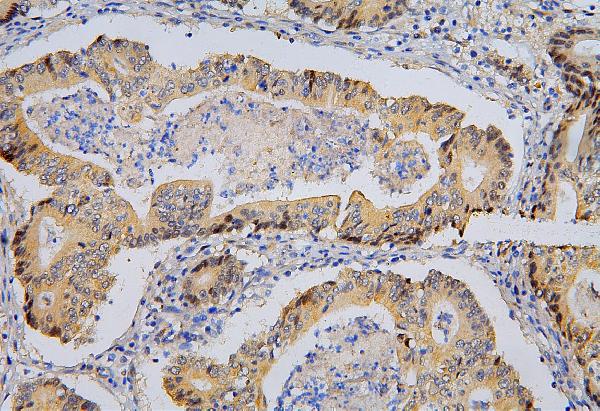 2 - Anti-BRG1 SMARCA4 Antibody Picoband™ (monoclonal, 3F4) ABO14862