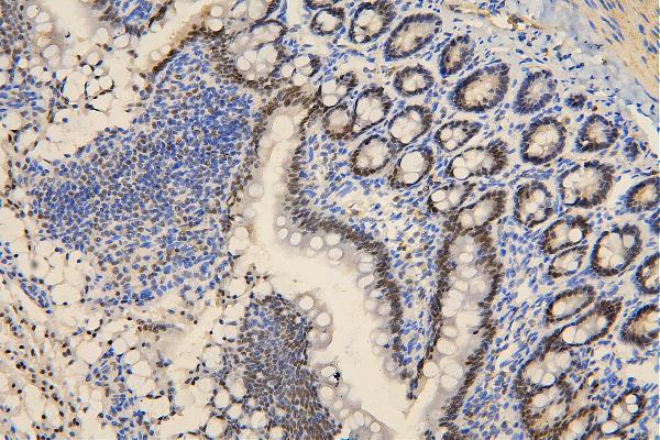 2 - Anti-BRG1 SMARCA4 Antibody Picoband™ (monoclonal, 3F4) ABO14862