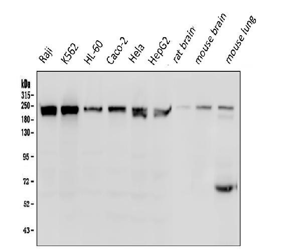 1 - Anti-BRG1 SMARCA4 Antibody Picoband™ (monoclonal, 3F4) ABO14862