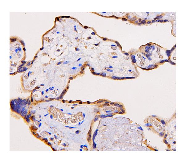 2 - Anti-ADK Antibody Picoband™ (monoclonal, 7F4) ABO14863