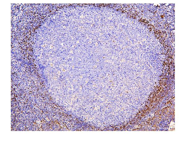 2 - Anti-ADK Antibody Picoband™ (monoclonal, 7F4) ABO14863