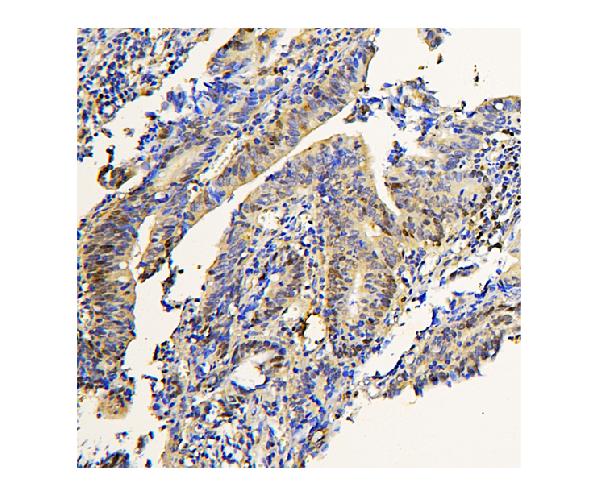 2 - Anti-ADK Antibody Picoband™ (monoclonal, 7F4) ABO14863