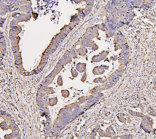 2 - Anti-COX IV COX4I1 Antibody Picoband™ (monoclonal, 4G11) ABO14864