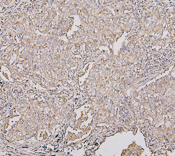 2 - Anti-COX IV COX4I1 Antibody Picoband™ (monoclonal, 4G11) ABO14864