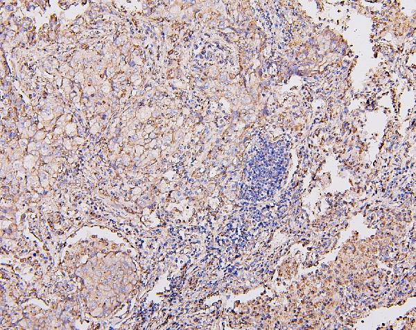 2 - Anti-COX IV COX4I1 Antibody Picoband™ (monoclonal, 4G11) ABO14864