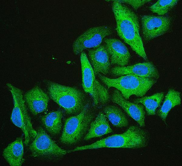 3 - Anti-Cofilin 2/CFL2 Antibody Picoband™ (monoclonal, 8C13) ABO14866