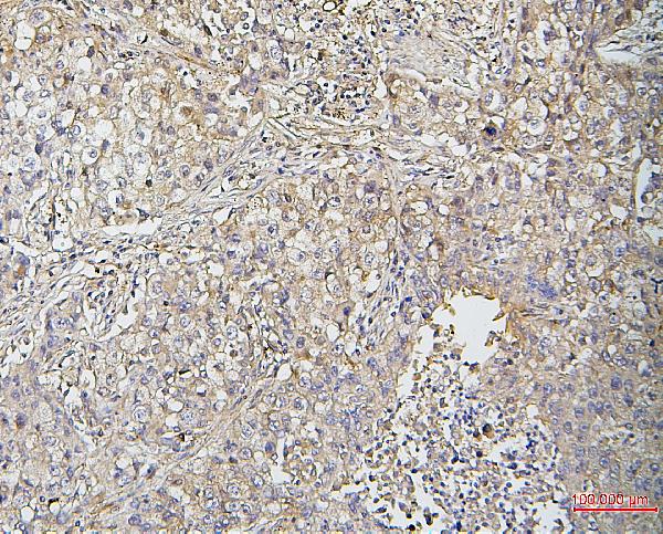 2 - Anti-Cofilin 2/CFL2 Antibody Picoband™ (monoclonal, 8C13) ABO14866