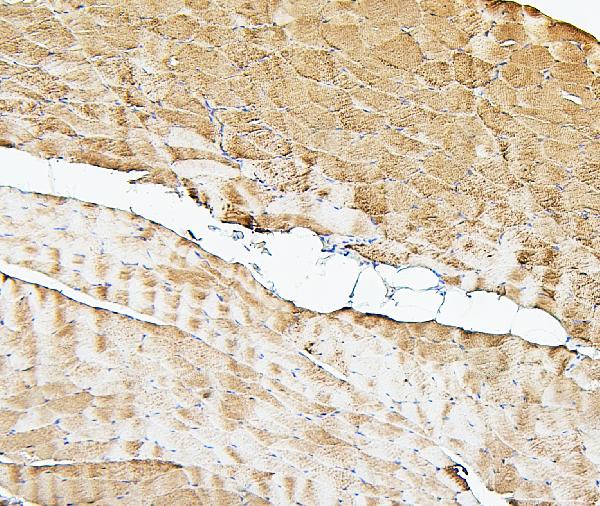 2 - Anti-Cofilin 2/CFL2 Antibody Picoband™ (monoclonal, 8C13) ABO14866