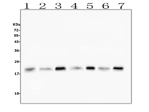 1 - Anti-Cofilin 2/CFL2 Antibody Picoband™ (monoclonal, 8C13) ABO14866