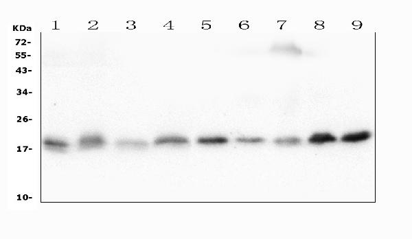 1 - Anti-Cofilin 2/CFL2 Antibody Picoband™ (monoclonal, 8C13) ABO14866