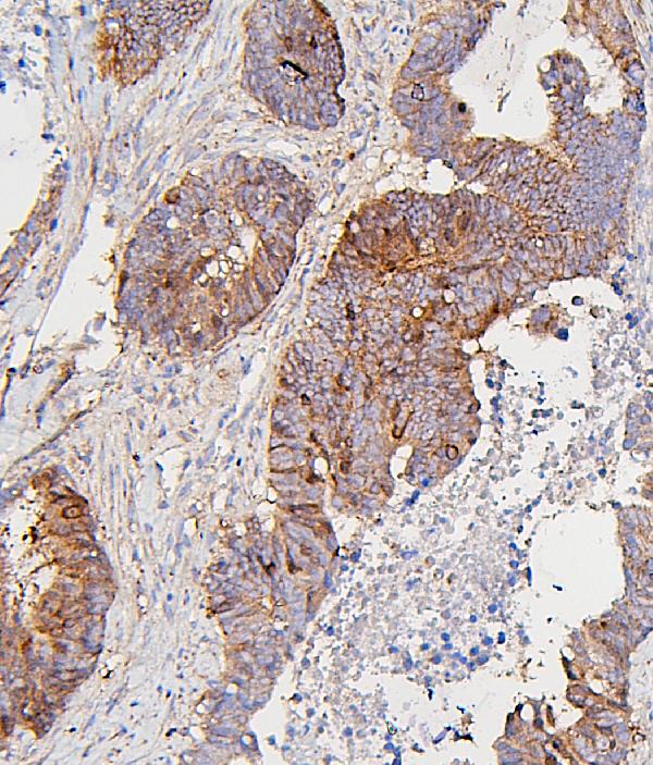 2 - Anti-CDK1 Antibody Picoband™ (monoclonal, 2G11) ABO14867