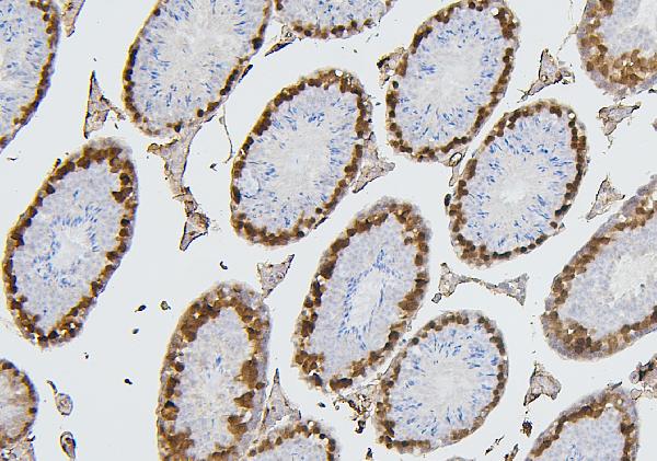 2 - Anti-CDK1 Antibody Picoband™ (monoclonal, 2G11) ABO14867