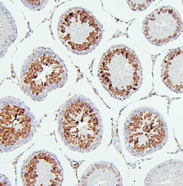 2 - Anti-CDK1 Antibody Picoband™ (monoclonal, 2G11) ABO14867