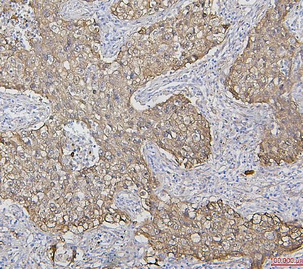 2 - Anti-Hsp27/HSPB1 Antibody Picoband™ (monoclonal, 3H3) ABO14869