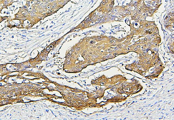 2 - Anti-Hsp27/HSPB1 Antibody Picoband™ (monoclonal, 3H3) ABO14869