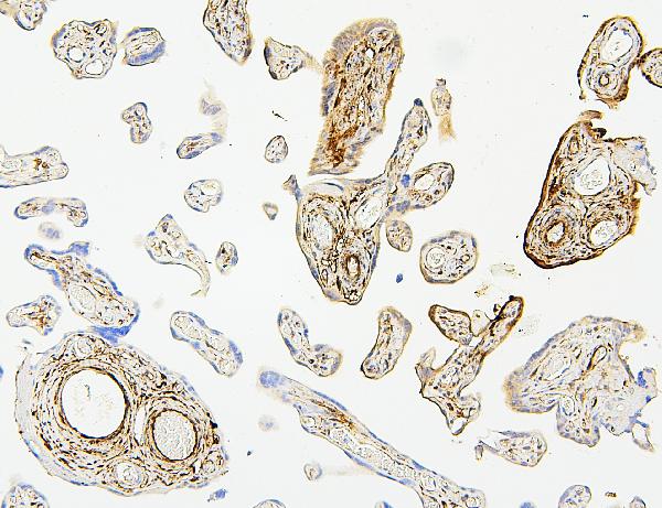 2 - Anti-Hsp27/HSPB1 Antibody Picoband™ (monoclonal, 3H3) ABO14869