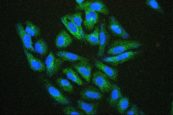 3 - Anti-Hsp27/HSPB1 Antibody Picoband™ (monoclonal, 3H3) ABO14869