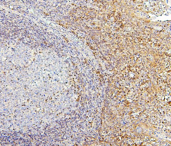 2 - Anti-PPCS Antibody Picoband™ (monoclonal, 7G13) ABO14871