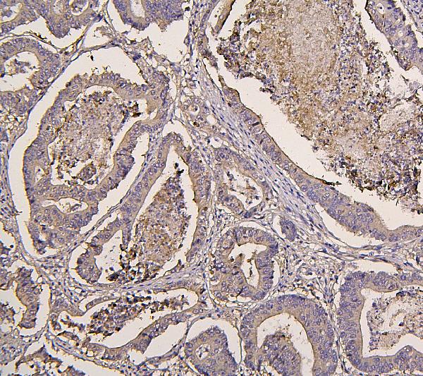 2 - Anti-IRS1 Antibody Picoband™ (monoclonal, 10I3) ABO14872