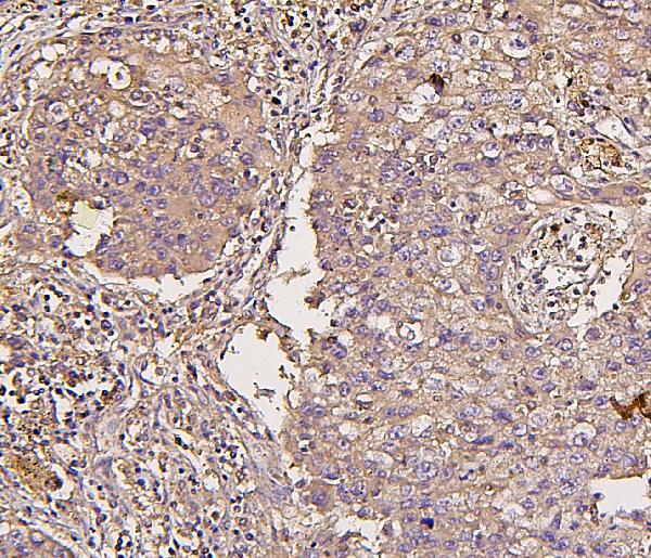 2 - Anti-IRS1 Antibody Picoband™ (monoclonal, 10I3) ABO14872