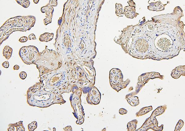 2 - Anti-IRS1 Antibody Picoband™ (monoclonal, 10I3) ABO14872