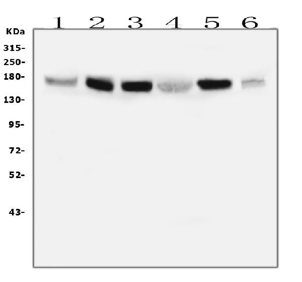 1 - Anti-IRS1 Antibody Picoband™ (monoclonal, 10I3) ABO14872