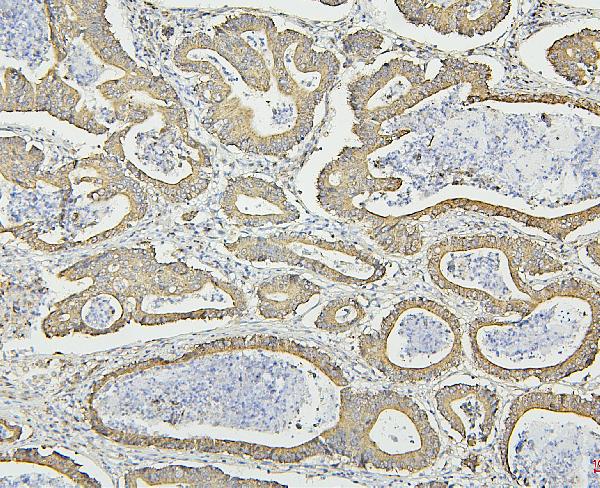 2 - Anti-Hsp60/HSPD1 Antibody Picoband™ (monoclonal, 6G2) ABO14873