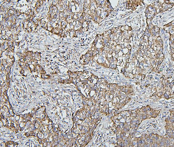 2 - Anti-Hsp60/HSPD1 Antibody Picoband™ (monoclonal, 6G2) ABO14873