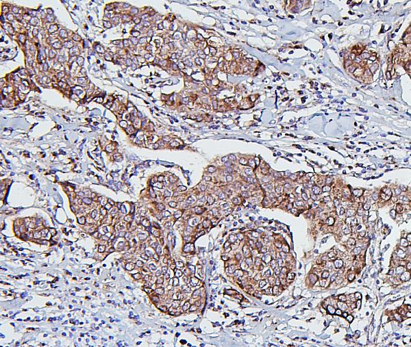 2 - Anti-Hsp60/HSPD1 Antibody Picoband™ (monoclonal, 6G2) ABO14873