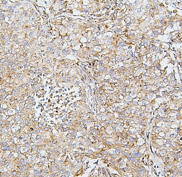 2 - Anti-SDHB Antibody Picoband™ (monoclonal, 2I3) ABO14874